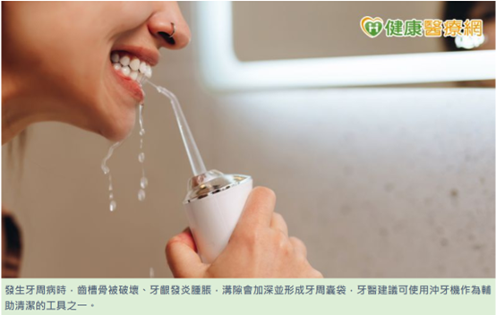 沖牙機作為清潔牙齒輔助工具