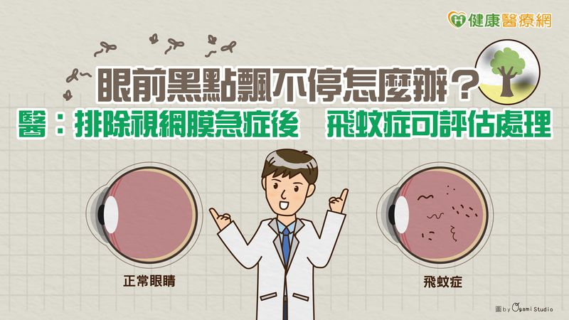 健康小學堂-眼前黑點飄不停怎麼辦?醫:排除視網膜急症後飛蚊症可評估處理