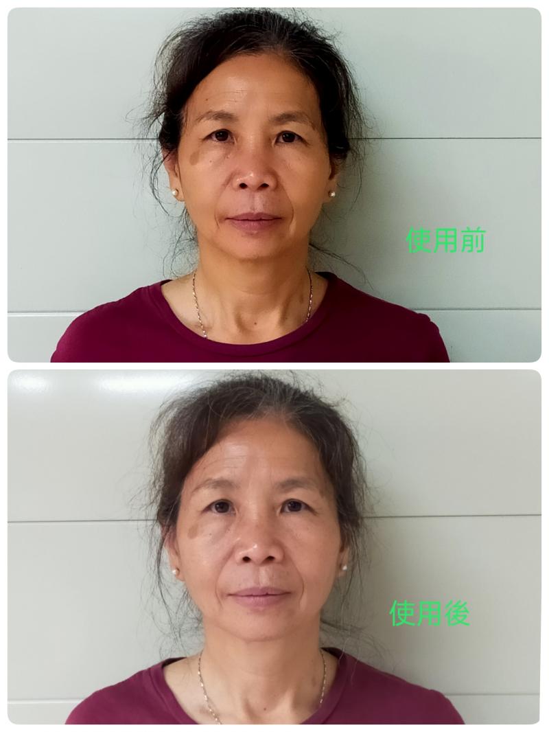 學員使用面膜後照片