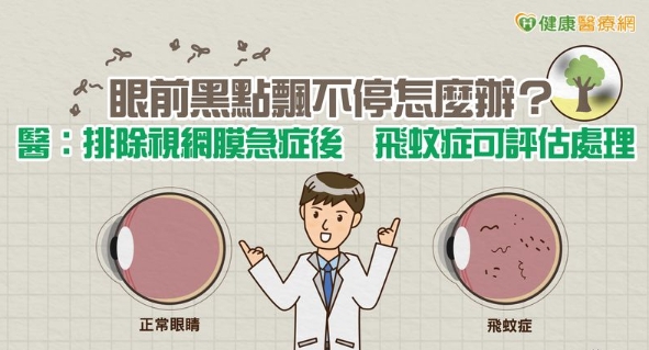 DOC健康小學堂5月號 【眼前黑點飄不停怎麼辦?醫:排除視網膜急症後飛蚊症可評估處理】